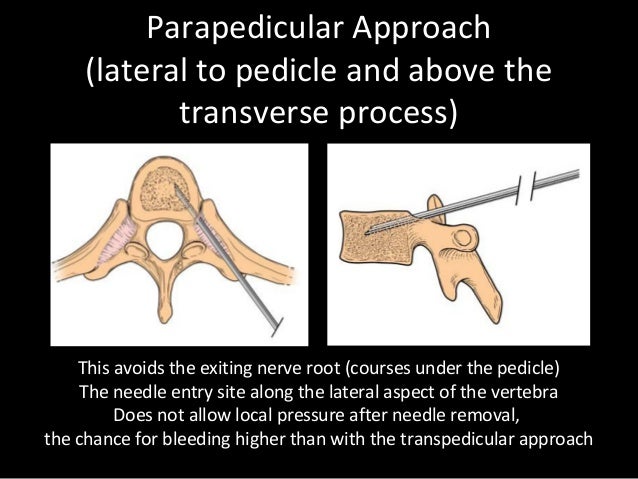 Percutaneous Vertebroplasty and Kyphoplasty